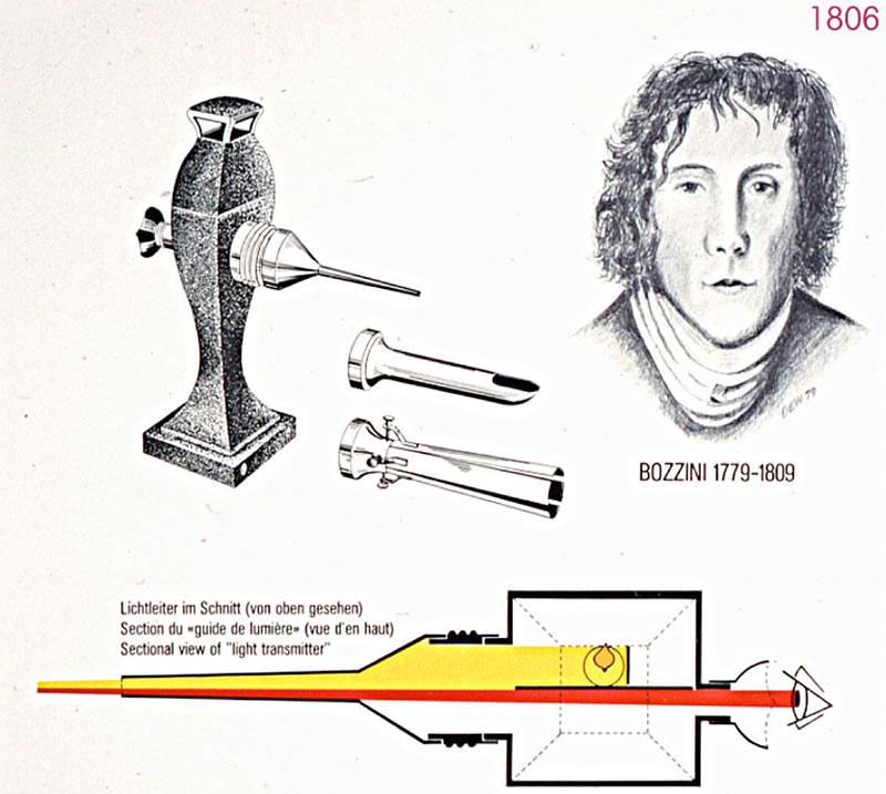 Bozzini, 1806